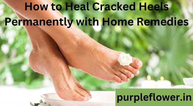 Home Remedy To Get Rid Of Cracked Heels Fast - YouTube-hkpdtq2012.edu.vn